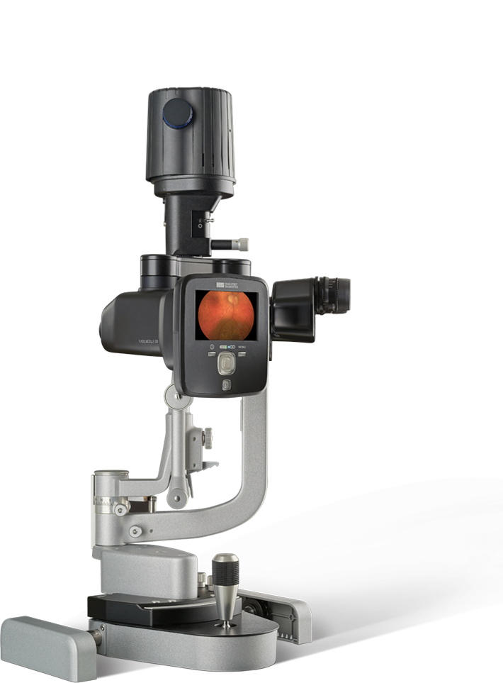 slit-lamp-fundus