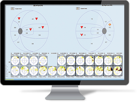 EyeSuite Software Update