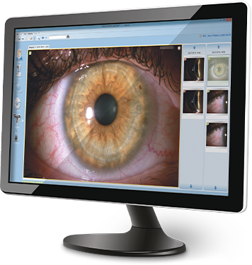 EyeSuite Monitor