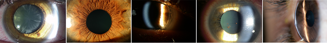 Super optics Super optics