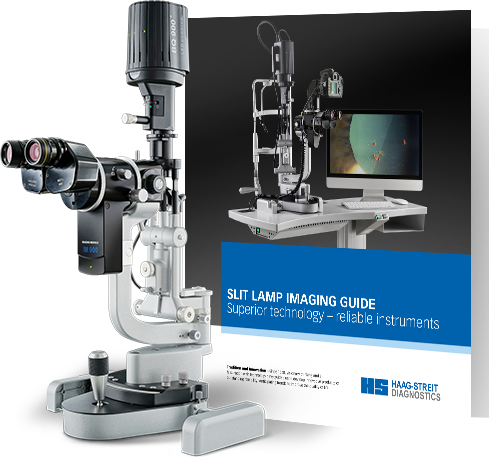 slit lamp